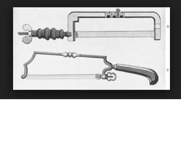Eighteenth Century Berlin Made Surgeon's Amputation Saw